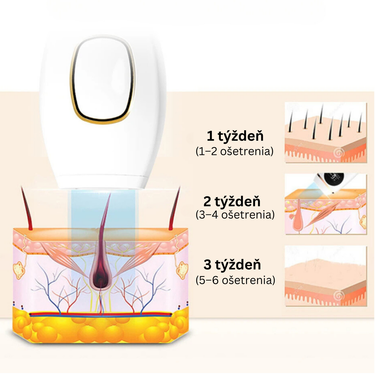 Glowie™ IPL epilátor – Zariadenie na odstránenie chĺpkov