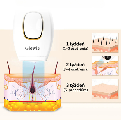 Glowie™ sada na odstraňovanie chĺpkov