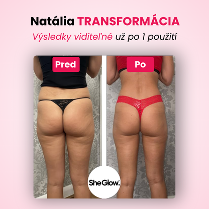 SheGlow™ PRO – sada na odstránenie celulitu